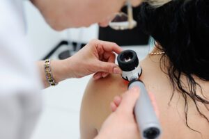 Trouver le meilleur dermatologue à Nice Ouest : comment choisir ?