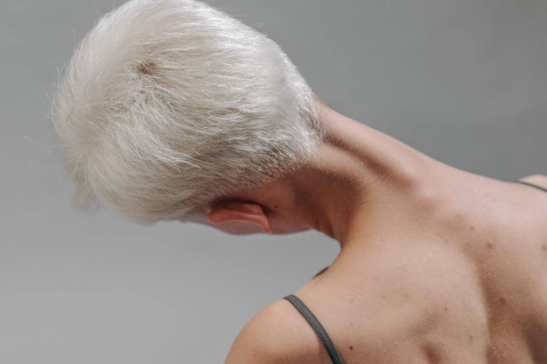 Mal à la nue : le stress en est-il la cause ?