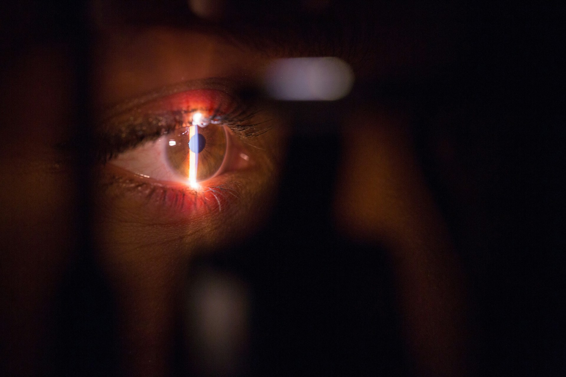oeil gros plan