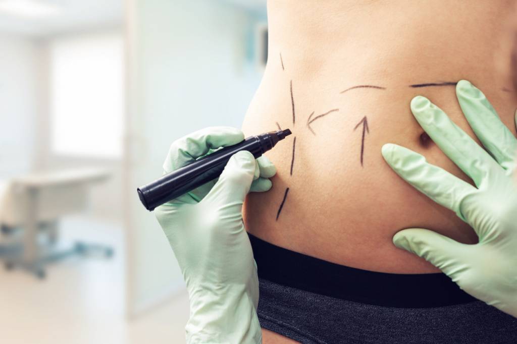 Préparatif chirurgie esthétique Tunisie
