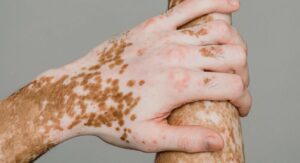 Poignet Gauche Qui Gratte: Quelle Signification Spirinelle?