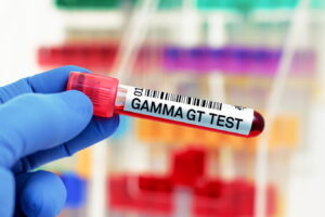 Quel Médicament Fait Monter Les Gamma GT?
