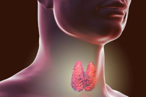 Thyroïde qui repousse aprours uneblation une: mythe ou réalité?
