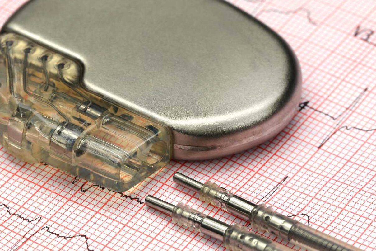 Défibriller implantable et Alcool: Précautions et recommandations