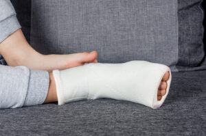 Fracture Malléole externe: Symptômes, Soins et rément