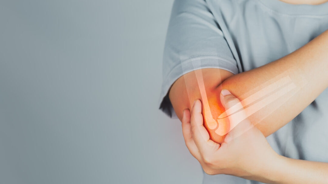 Coude Fracturé: Symptômes, Diagnostic et Traitement