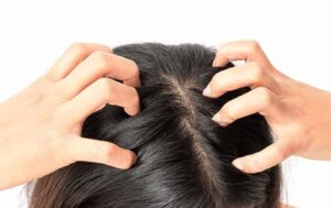 Douleur Au cuir Chevelu et Haut du Crâne: Que Faire?
