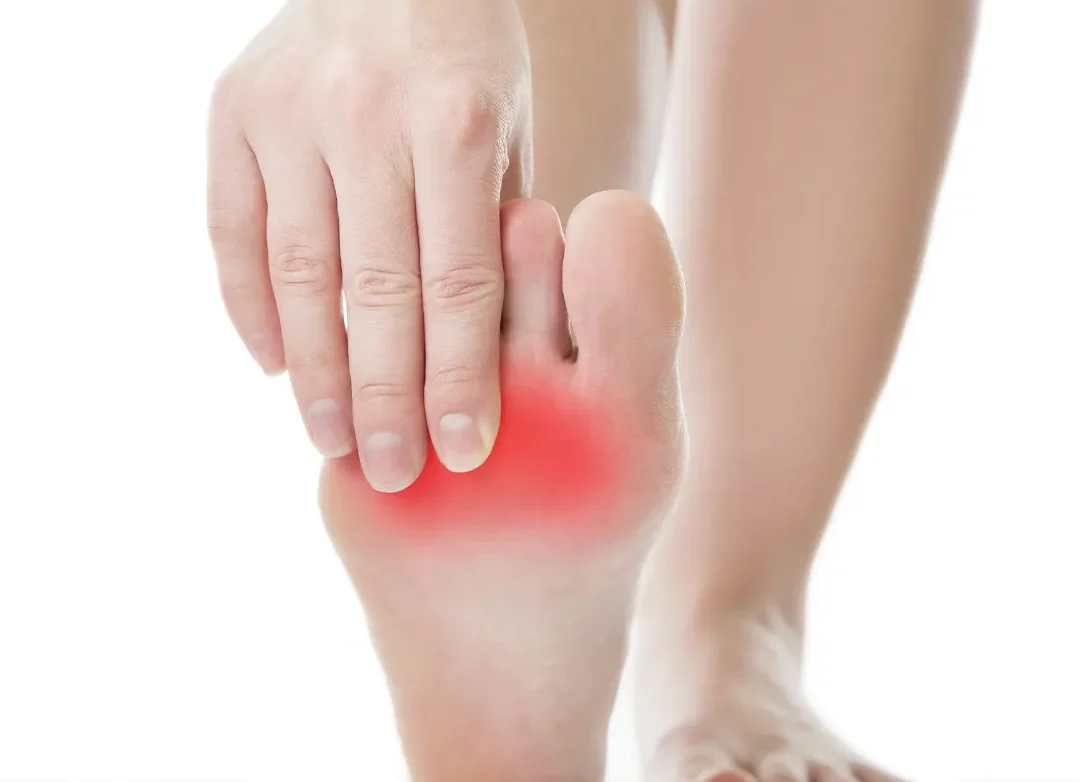 Douleur AU Pie: Causes, zones Touchees et Solutions