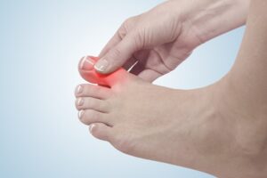 Douleur Lancinante Au Gros Orteil: Que Peut-Elle Révéler?