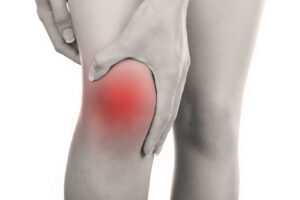 Peut-on Marcher AVEC UNE RUPTURE DES LIGAMENTS CROISÉS?