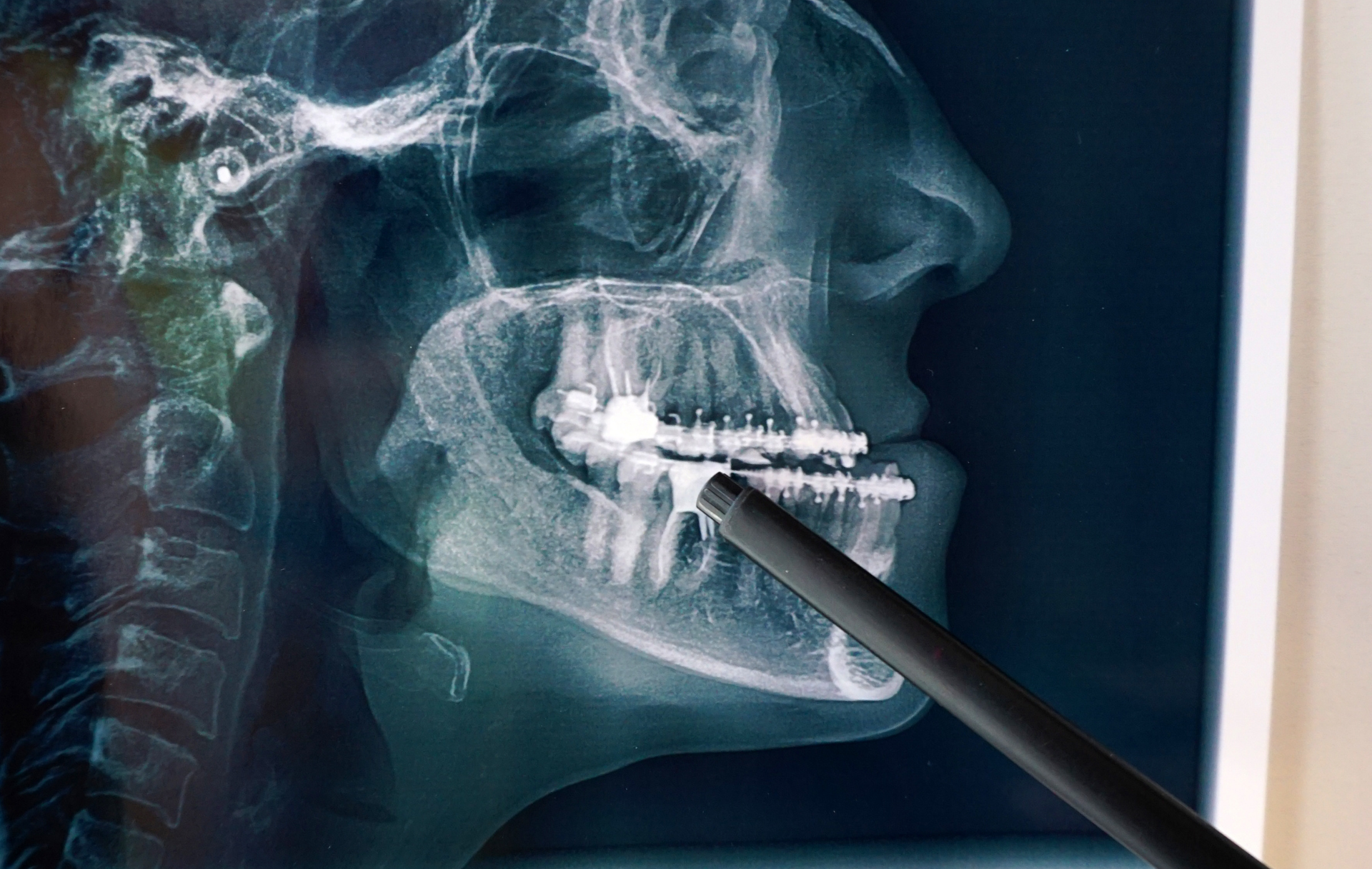 Consultation en chirurgie orale et maxillo-faciale